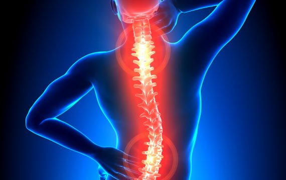 New York Spinal Cord Injury Lawyers